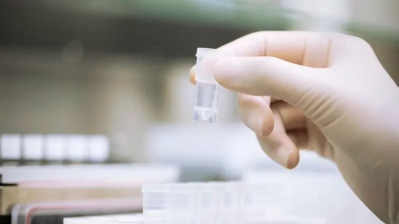 High-yield AAV production using a “mini-helper” plasmid with optimized strong promoters